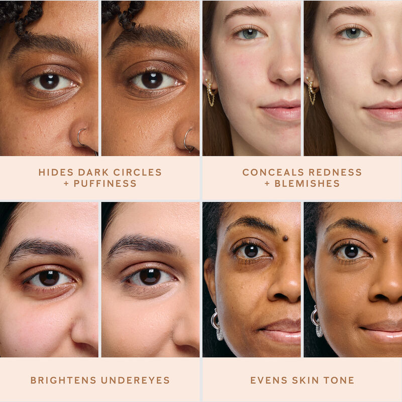 Various skin care challenges on light, medium, and deep skin tones are shown as before and after images